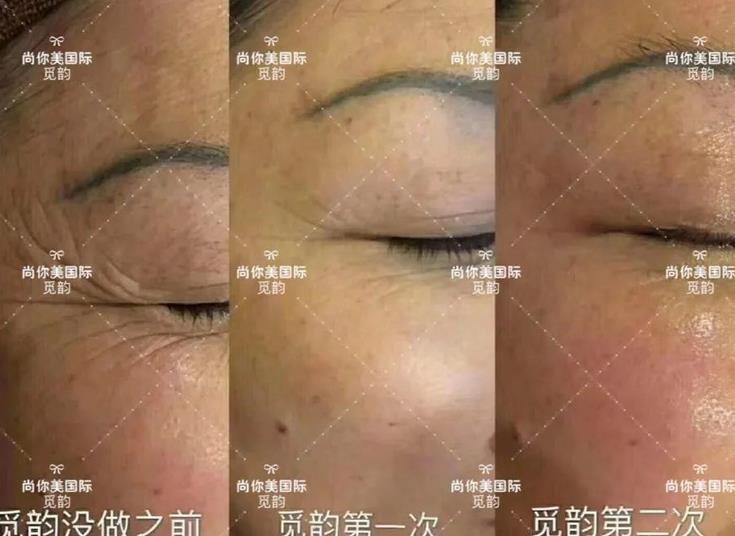 美白面膜哪個牌子的效果好價格便宜點