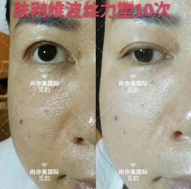 美白面膜哪個牌子的效果好價格便宜點