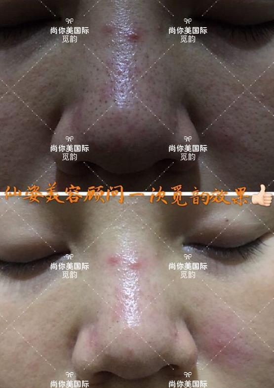 美白面膜哪個牌子的效果好價格便宜點