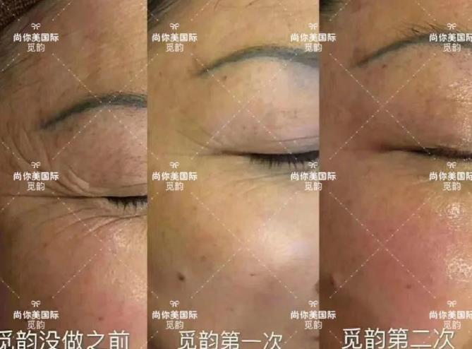 美容院拓客套盒方法，眼部面部身體拓客套盒話術(shù)