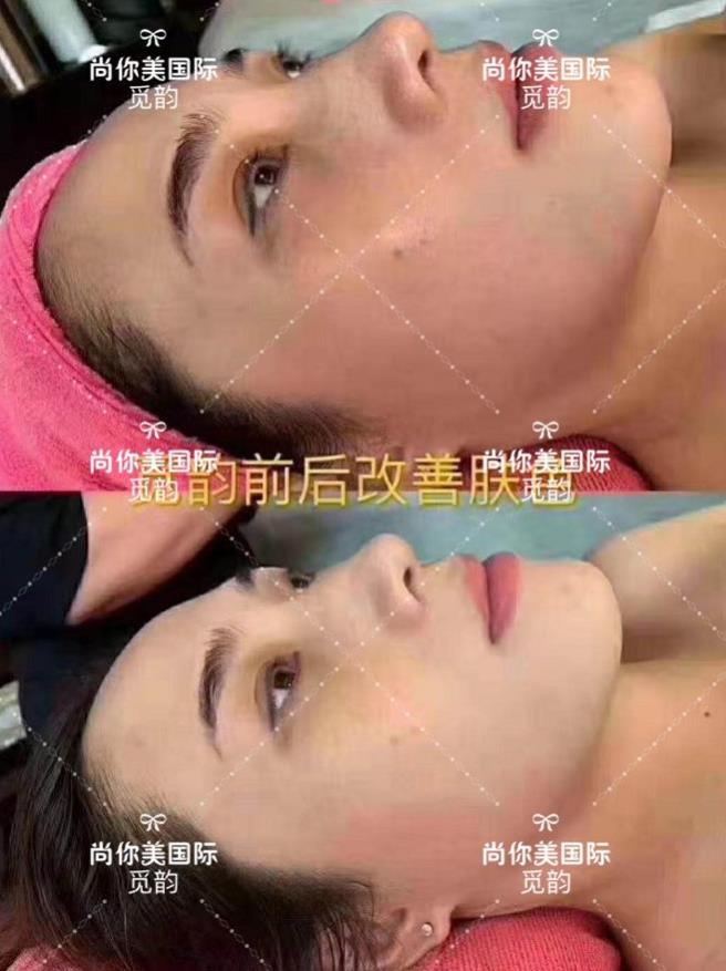美容院拓客套盒方法，眼部面部身體拓客套盒話術(shù)