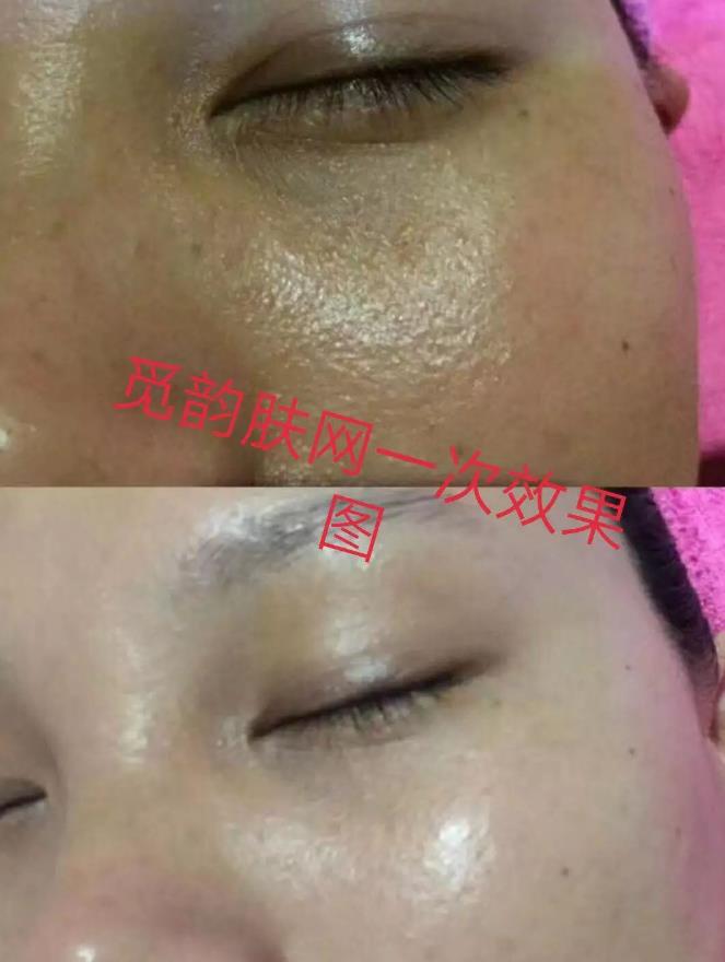 美容院美容產品加盟項目覓韻