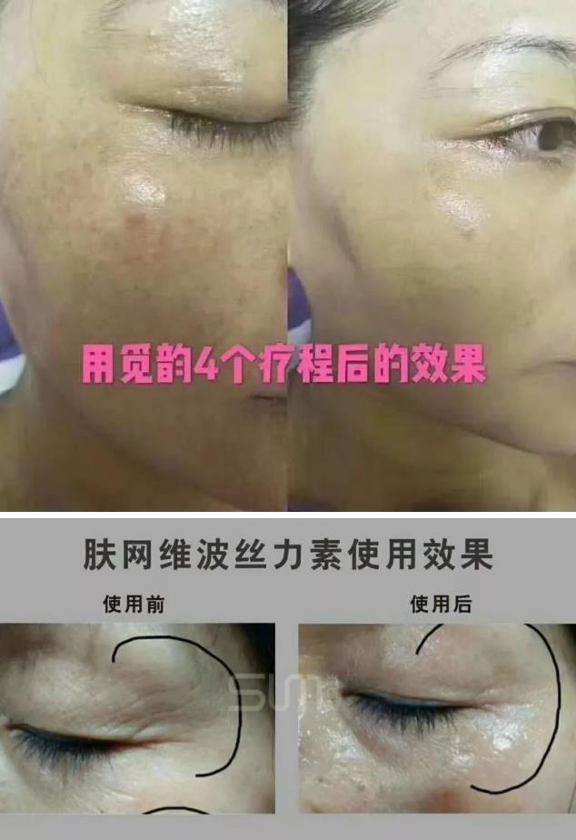 美容院美容產品加盟項目覓韻